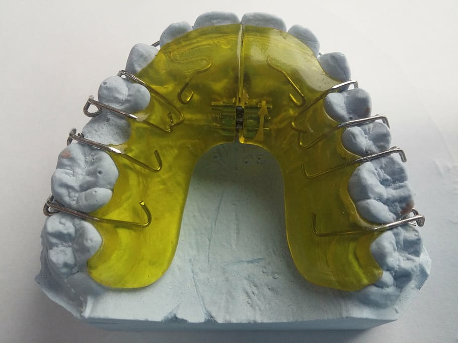 yellow, white, teeth brace molder, surface, dental braces, dentist, orthodontics, dental rail, seemed, tooth