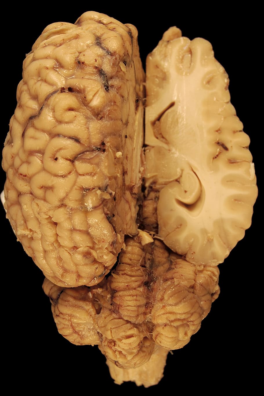 cérebro humano, Cérebro, Anatomia, Cavalo, Biologia, Dorsal, corpo, medicina veterinária, cerebelo, hemisfério