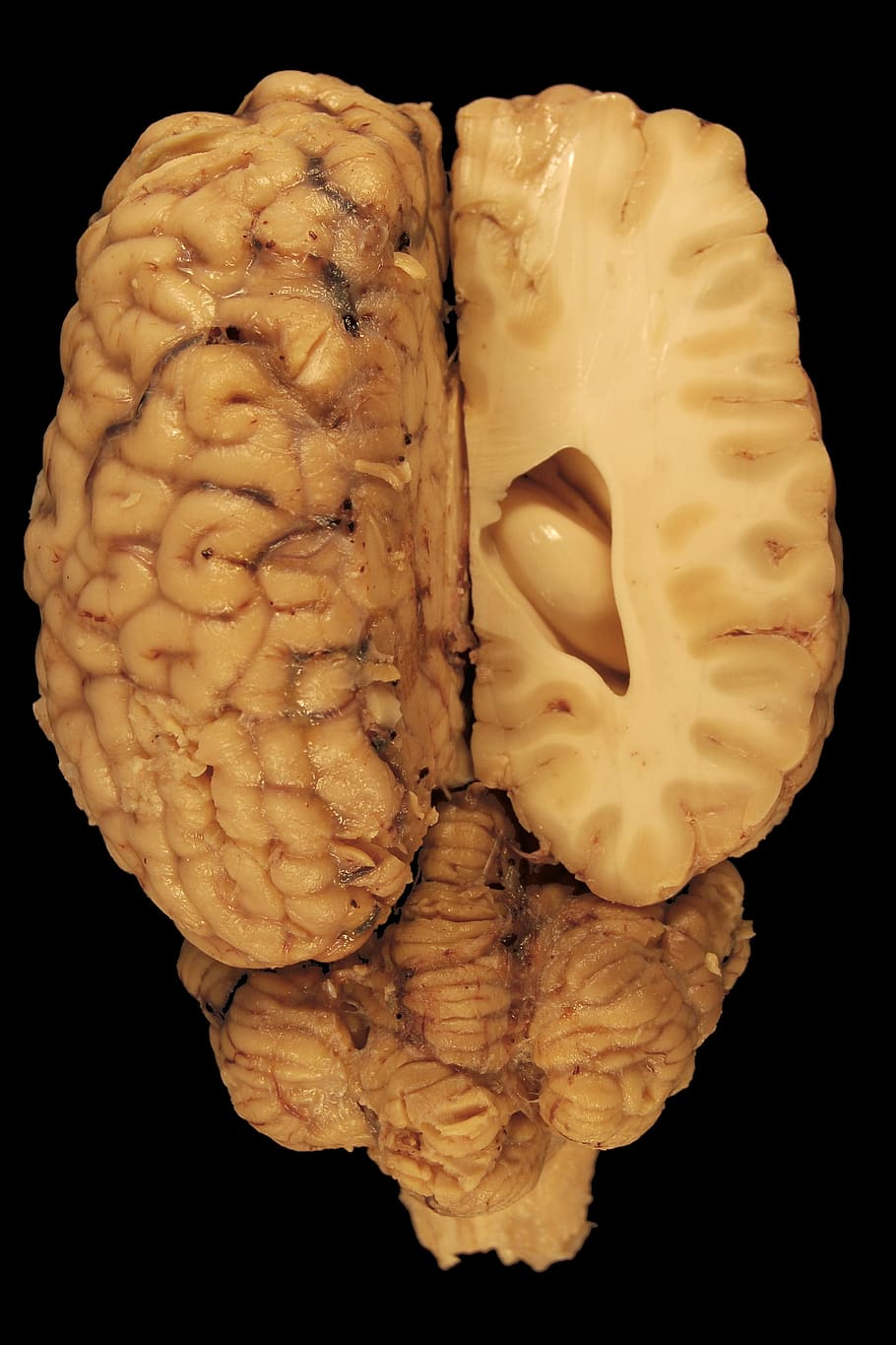 papel de parede do cérebro humano, Cérebro, Anatomia, Olhos, Cavalo, Paerparat, biologia, dorsal, corpo, medicina veterinária