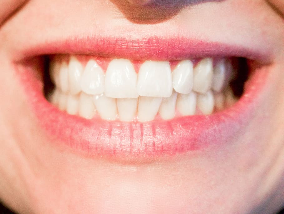 人の歯, 歯, 歯科医, 歯科, 口, 口腔, 白, 笑顔, 女性, 健康診断