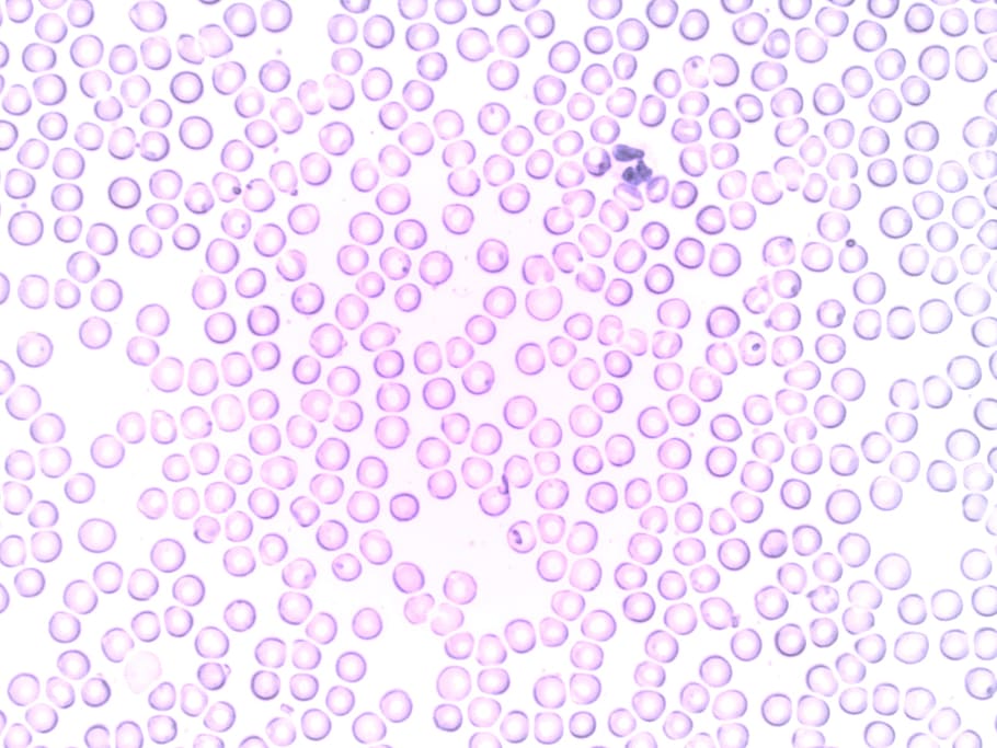 紫色の泡, 血液, 好中球, セグメント化, セグメント化された好中球, 顆粒球, 血球, 実験室, 顕微鏡, 血液学