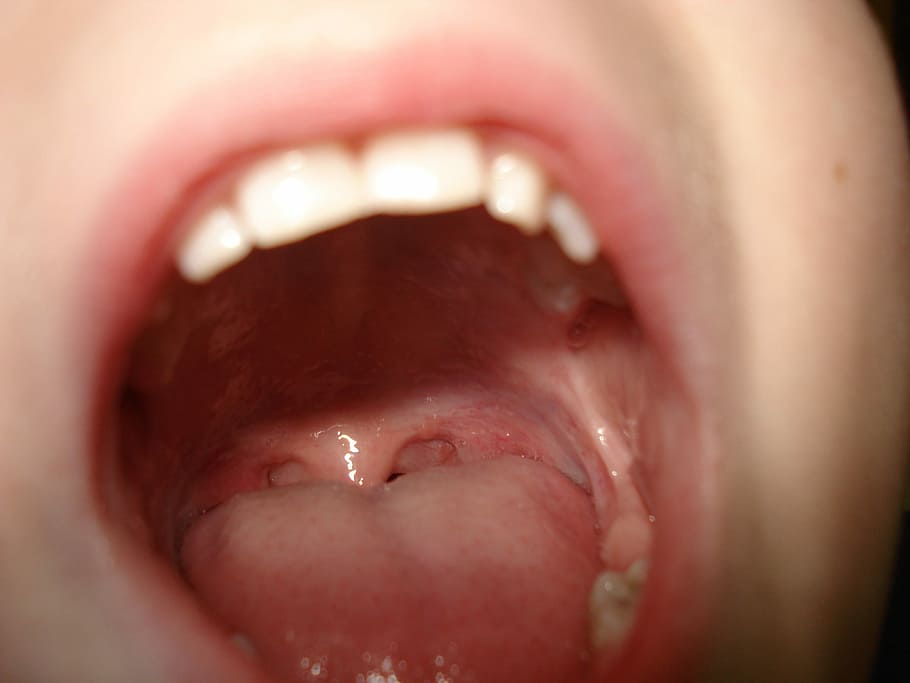 boca aberta da pessoa, dentes, boca, língua, lábios, bonito, cabeça, doce, jovem, masculino