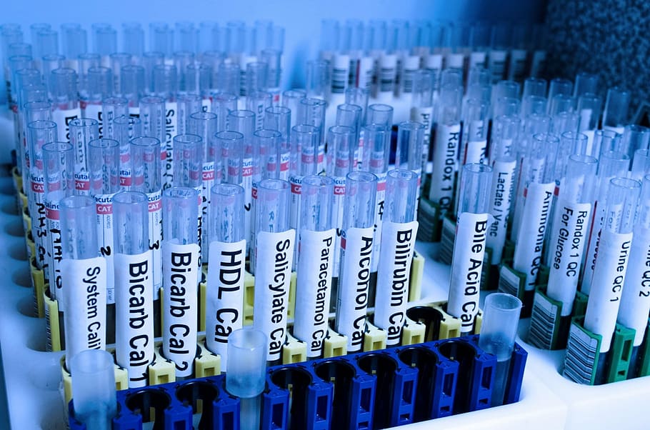 tubos de ensaio de vidro, teste, tubo, laboratório, médico, pesquisa, droga, água, clínica, saúde