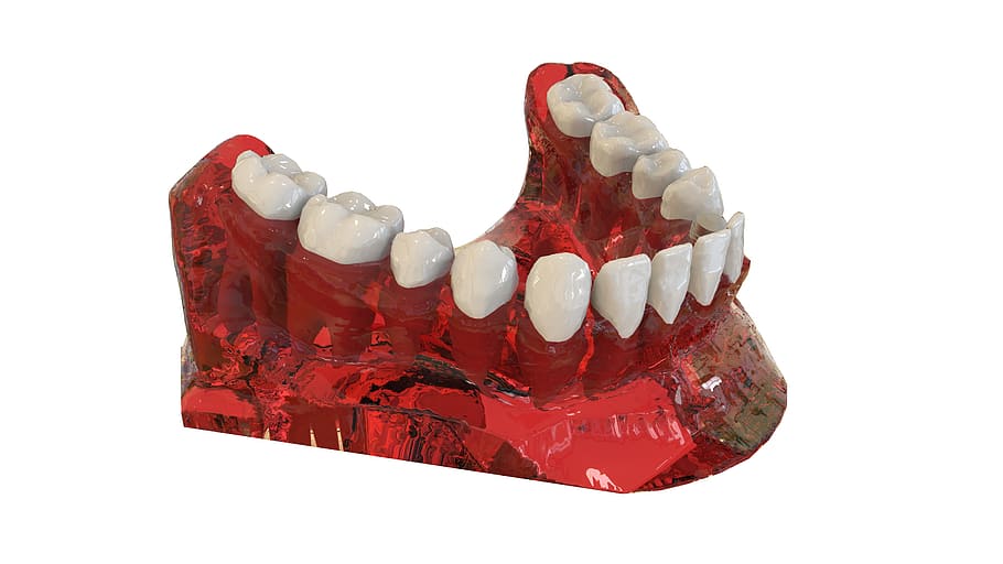 teeth, jaw, 3d model, orthodontics, the implant, white background, red, cut out, studio shot, indoors