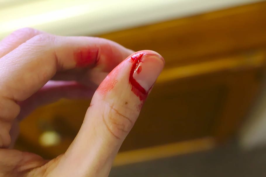 fotografía de primer plano, uña, sangre, accidente, sangrado, dedo sangrante, fregadero, corte, emergencia, dedo
