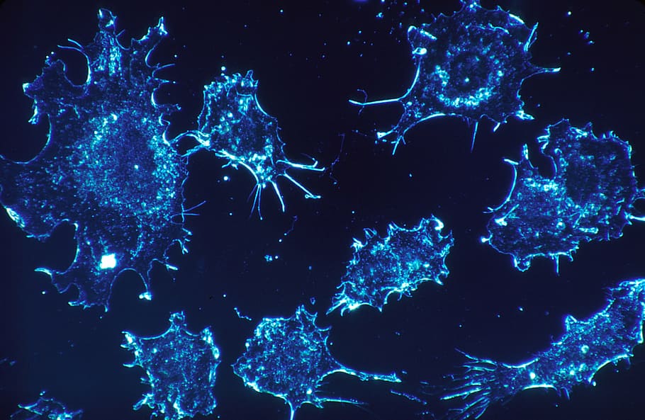 gambar mikroskopis amuba, sel kanker, sel, pemindaian, pemindaian mikroskop elektron, teknologi, mikroskopis, medis, manusia, biru