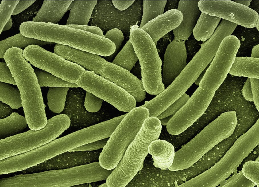 mikro, fotografi, bakteri, bakteri koli, escherichia coli, penyakit, patogen, mikroskop, mikroskop elektron, perbesaran