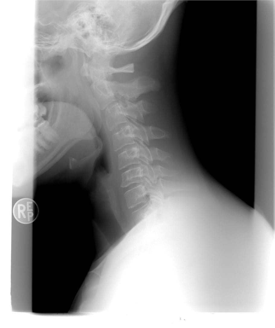 首のx線, 頸椎, x線, 患者, 一人, 屋内, 女性, 人体部分, 大人, 骨