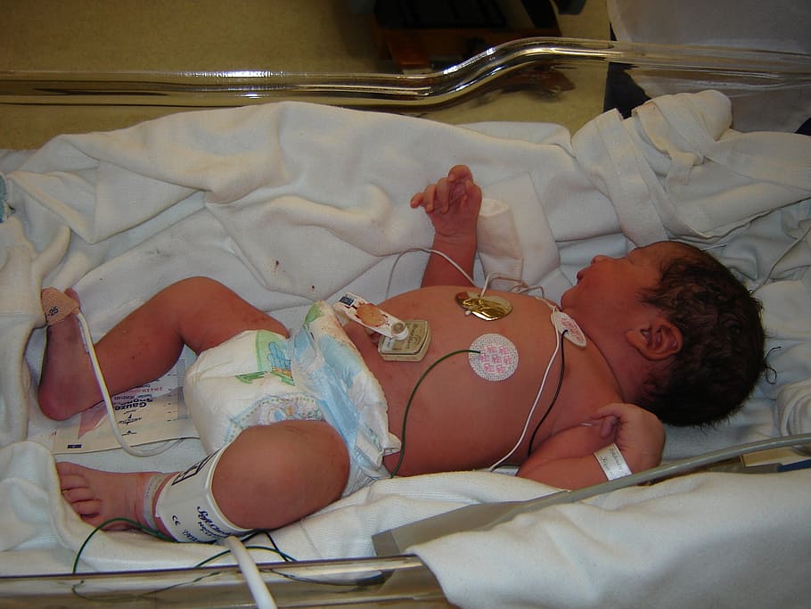 baby, sleeps, white, textile, bebe, hospital, doctor, boarding bebe, intensive care, newborn