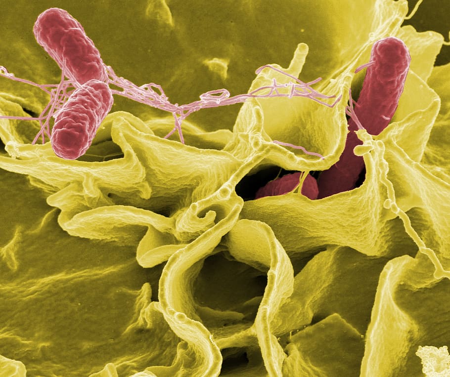 foto microbiana, salmonela, bactérias, microscópio eletrônico, varredura, microscopia, doença, infecção, infecciosa, biologia