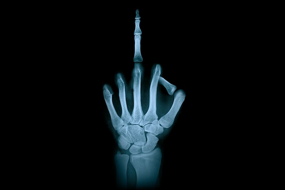 hand, middle finger, x-ray radiation, finger gesture, anatomy, bone, finger, thumb, index finger, pinkie finger