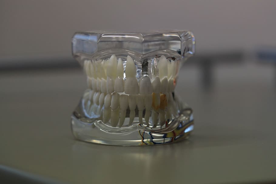 clear, glass mouth paperweight, Dentistry, Dentals, Teeth, Model, Jaw, tooth, healthcare, oral
