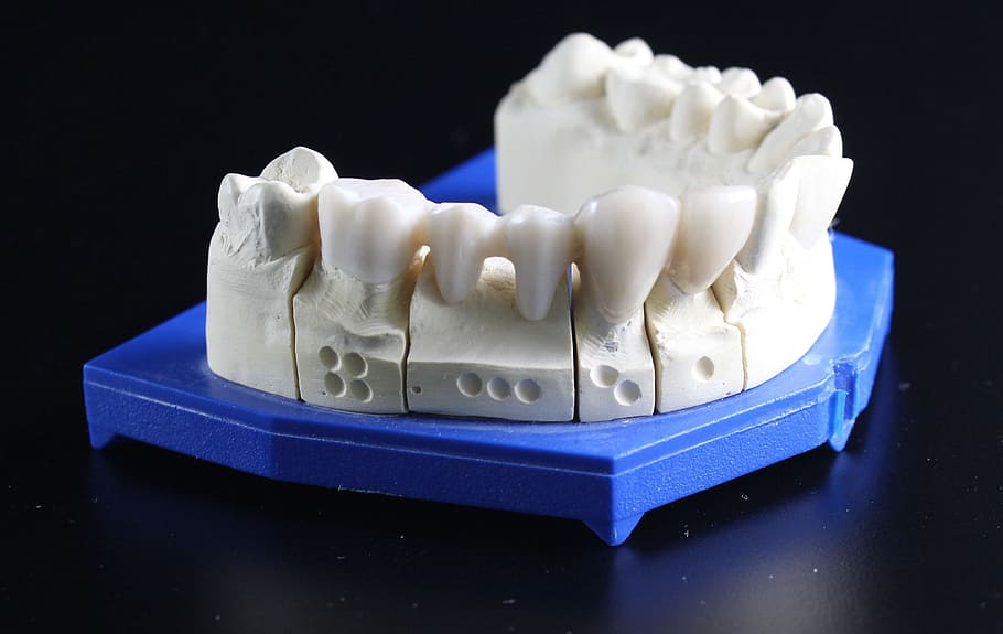blanco, dentaduras postizas, moldeador, reemplazo dental, diente, técnico dental, azul, en el interior, alimentos y bebidas, fondo negro