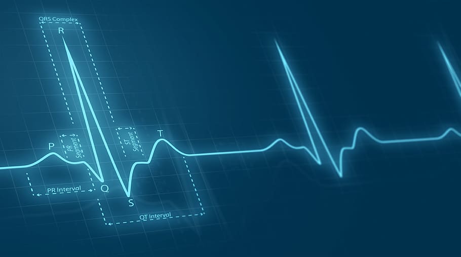 cardiac pulse, time series, statistics, diagram, business, graph, chart, blue, finance, data