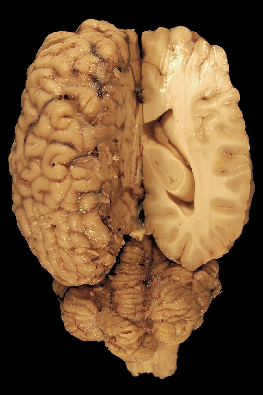 ilustração do cérebro, cérebro, anatomia, olhos, cavalo, biologia, dorsal, corpo, medicina veterinária, cerebelo