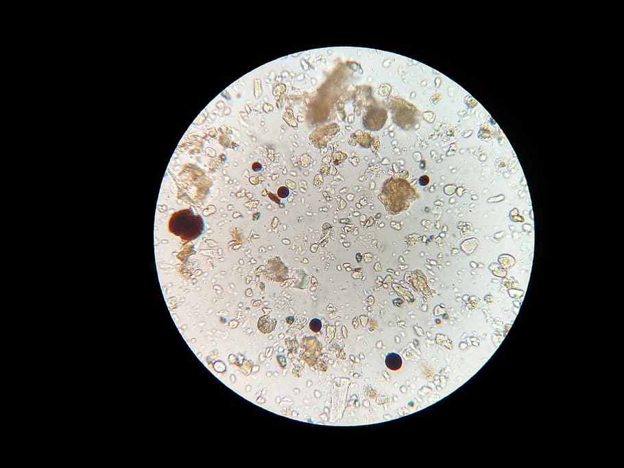 gambar mikroskopis, mikroba tanah, mikroskop, sampel tanah, sains, latar belakang hitam, biologi, lingkaran, bentuk geometris, perbesaran