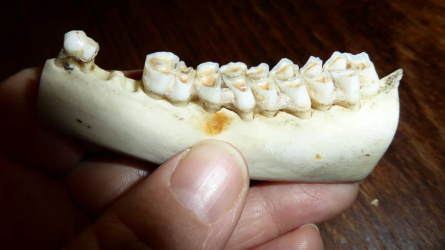 teeth, tooth, dental caries, bone, skeleton, animal world, pine, human hand, hand, human body part