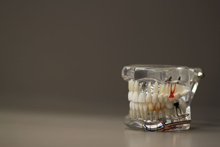 white artificial teetg, white, artificial, dentistry, dentals, teeth, model, jaw, oral, care